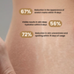 Edorica™ Stretch Mark Reduction Cream