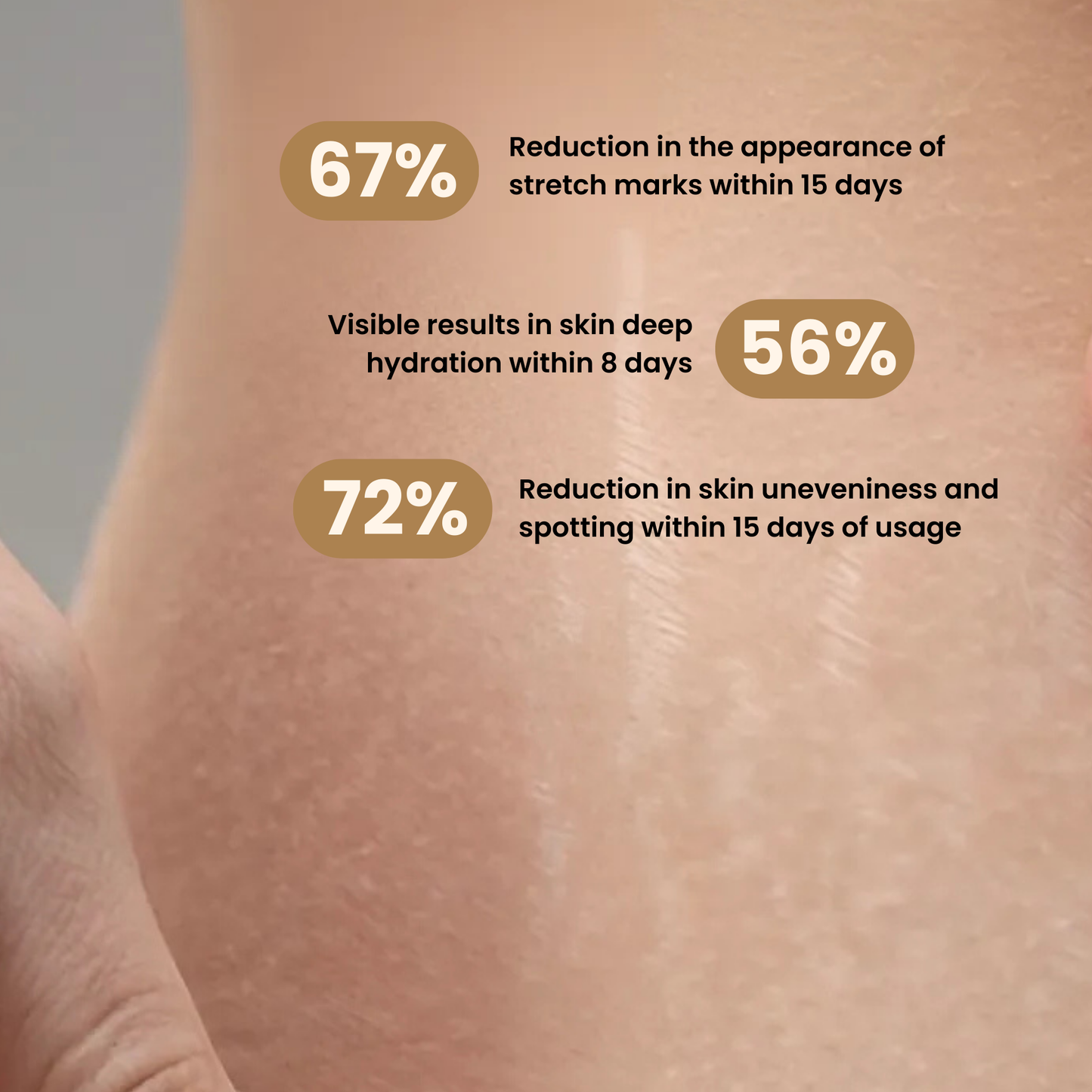 Edorica™ Stretch Mark Reduction Cream